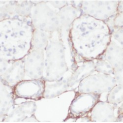 Estradiol 17-Beta-Dehydrogenase 11 (HSD17B11) Antibody