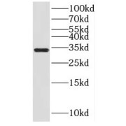 WB analysis of mouse liver tissue, using HSD17B11 antibody (1/800 dilution).