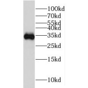 WB analysis of mouse liver tissue, using HSD17B11 antibody (1/800 dilution).