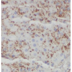 Estradiol 17-Beta-Dehydrogenase 8 (HSD17B8) Antibody