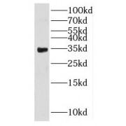 WB analysis of human testis tissue, using HSD17B8 antibody (1/500 dilution).