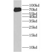 WB analysis of K-562 cells, using HSF1 antibody (1/1000 dilution).