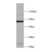 WB analysis of HepG2 cells, using HSF2 antibody (1/1000 dilution).