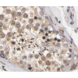 Heat Shock Transcription Factor, Y-Linked 1 (HSFY1) Antibody