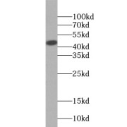 WB analysis of human testis tissue, using HSFY1 antibody (1/1000 dilution).