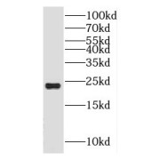 WB analysis of mouse skeletal muscle tissue, using HSPB7 antibody (1/400 dilution).