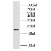 WB analysis of HEK-293 cells, using HSPB8 antibody (1/400 dilution).