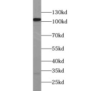 WB analysis of MCF7 cells, using HSPH1 antibody (1/1000 dilution).