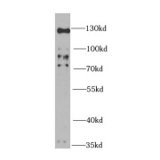 WB analysis of HeLa cells, using HTATSF1 antibody (1/1000 dilution).