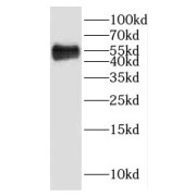 WB analysis of human placenta tissue, using HTRA4 antibody (1/500 dilution).