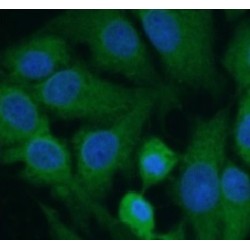 ELAV-Like Protein 4 (ELAVL4) Antibody