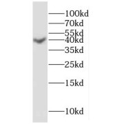 WB analysis of human cerebellum tissue, using HuD antibody (1/800 dilution).