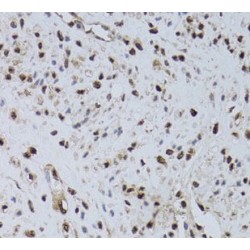 Checkpoint Protein HUS1 (HUS1) Antibody