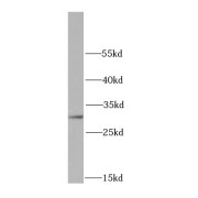 WB analysis of BxPC-3 cells, using HUS1 antibody (1/0 dilution).