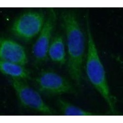 Hydrogen Voltage Gated Channel Protein 1 (HVCN1) Antibody