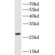 WB analysis of Raji cells, using HVCN1 antibody (1/600 dilution).