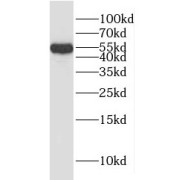 WB analysis of human brain tissue, using HYAL3 antibody (1/500 dilution).