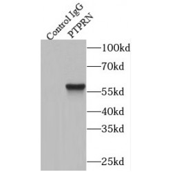 IA-2 / PTPRN Antibody