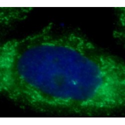 Peptidyl-tRNA Hydrolase ICT1, Mitochondrial (ICT1) Antibody