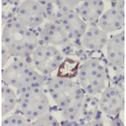 Insulin Degrading Enzyme (IDE) Antibody