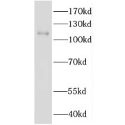 WB analysis of HepG2 cells, using IDE antibody (1/300 dilution).