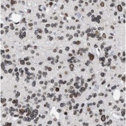 Isocitrate Dehydrogenase 1, Soluble (IDH1) Antibody