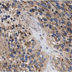 Isocitrate Dehydrogenase 1, Soluble (IDH1) Antibody