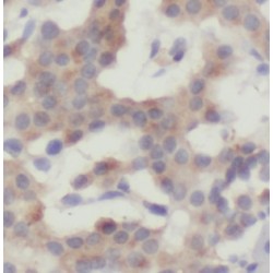 Isocitrate Dehydrogenase 1, Soluble (IDH1) Antibody