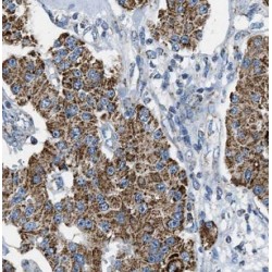 Isocitrate Dehydrogenase 2, Mitochondrial (IDH2) Antibody