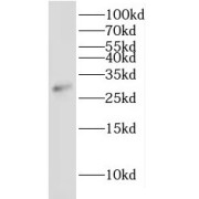 WB analysis of human skeletal muscle tissue, using IDI2 antibody (1/2000 dilution).