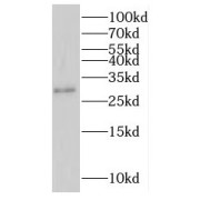 WB analysis of human colon tissue, using IFI30 antibody (1/400 dilution).
