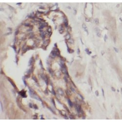 Interferon Induced Protein With Tetratricopeptide Repeats 1 (IFIT1) Antibody