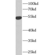 WB analysis of U-937 cells, using IFIT1 antibody (1/600 dilution).