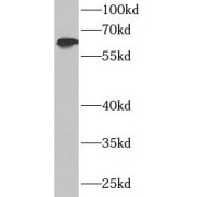 WB analysis of HepG2 cells, using IFIT3 antibody (1/600 dilution).