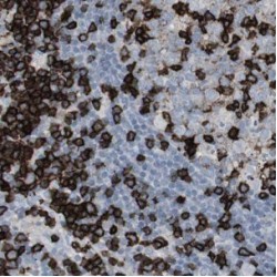 Interferon Induced Transmembrane Protein 1 (IFITM1) Antibody