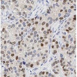 Interferon Induced Transmembrane Protein 2 (IFITM2) Antibody