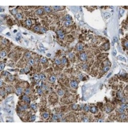 Interferon-Induced Transmembrane Protein 3 (IFITM3) Antibody