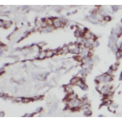 Interferon-Induced Transmembrane Protein 3 (IFITM3) Antibody