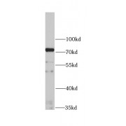 WB analysis of K562 cells, using IFNAR1 antibody (1/1000 dilution).