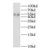 WB analysis of A549 cells, using IFNGR2 antibody (1/500 dilution).