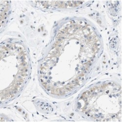 Intraflagellar Transport Protein 122 Homolog (IFT122) Antibody