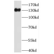 WB analysis of mouse testis tissue, using IFT122 antibody (1/300 dilution).