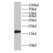 WB analysis of mouse testis tissue, using IFT20 antibody (1/600 dilution).