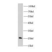 WB analysis of HeLa cells, using IFT25 antibody (1/500 dilution).