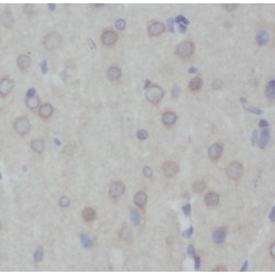 Intraflagellar Transport Protein 27 Homolog (IFT27) Antibody