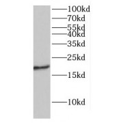 WB analysis of human RPE cells, using IFT27 antibody (1/500 dilution).