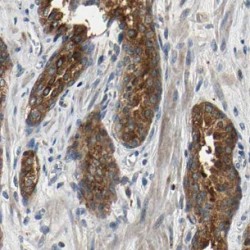 Intraflagellar Transport Protein 81 Homolog (IFT81) Antibody