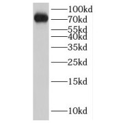 WB analysis of mouse kidney tissue, using IFT81 antibody (1/500 dilution).