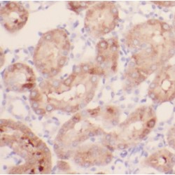 Intraflagellar Transport Protein 88 Homolog (IFT88) Antibody