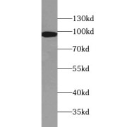 WB analysis of NCCIT cells, using IFT88 antibody (1/4000 dilution).